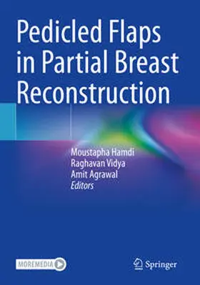 Hamdi / Vidya / Agrawal |  Pedicled Flaps in Partial Breast Reconstruction | Buch |  Sack Fachmedien