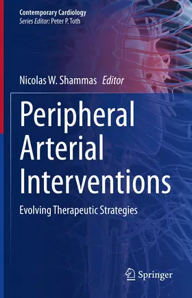 Shammas |  Peripheral Arterial Interventions | eBook | Sack Fachmedien