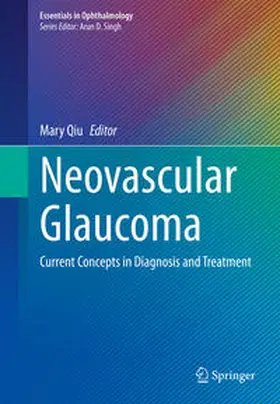 Qiu |  Neovascular Glaucoma | eBook | Sack Fachmedien
