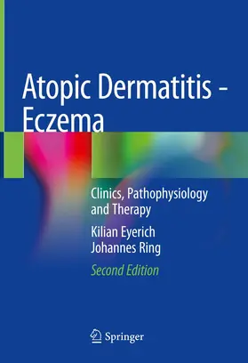 Eyerich / Ring | Atopic Dermatitis - Eczema | Buch | 978-3-031-12498-3 | www.sack.de
