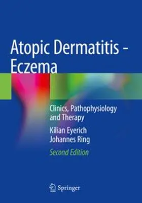 Eyerich / Ring | Atopic Dermatitis - Eczema | Buch | 978-3-031-12501-0 | www.sack.de