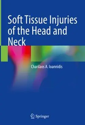 Ioannidis |  Soft Tissue Injuries of the Head and Neck | eBook | Sack Fachmedien