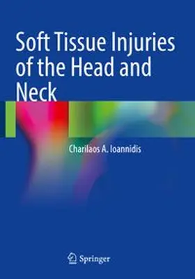 Ioannidis | Soft Tissue Injuries of the Head and Neck | Buch | 978-3-031-14917-7 | www.sack.de