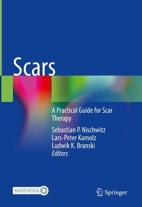 Nischwitz / Branski / Kamolz |  Scars | Buch |  Sack Fachmedien