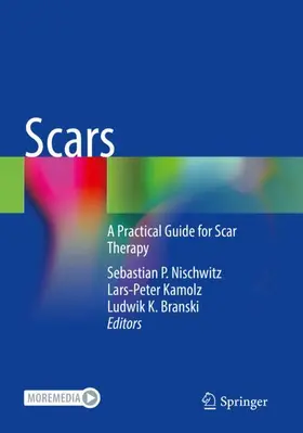 Nischwitz / Branski / Kamolz |  Scars | Buch |  Sack Fachmedien