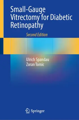 Spandau / Tomic |  Small-Gauge Vitrectomy for Diabetic Retinopathy | Buch |  Sack Fachmedien
