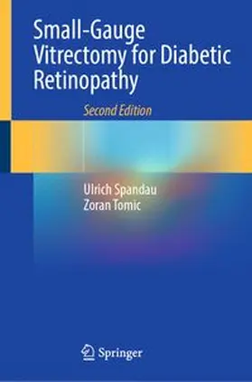 Spandau / Tomic |  Small-Gauge Vitrectomy for Diabetic Retinopathy | eBook | Sack Fachmedien