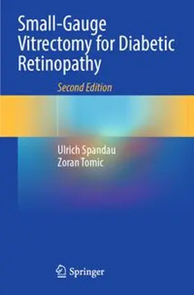 Spandau / Tomic |  Small-Gauge Vitrectomy for Diabetic Retinopathy | Buch |  Sack Fachmedien