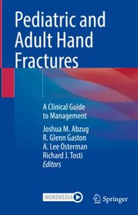 Abzug / Gaston / Osterman |  Pediatric and Adult Hand Fractures | eBook | Sack Fachmedien