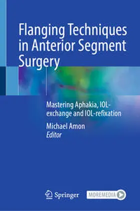 Amon | Flanging Techniques in Anterior Segment Surgery | E-Book | sack.de