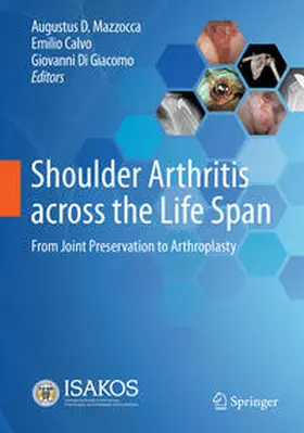Mazzocca / Di Giacomo / Calvo |  Shoulder Arthritis across the Life Span | Buch |  Sack Fachmedien