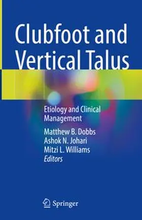 Dobbs / Johari / Williams |  Clubfoot and Vertical Talus | eBook | Sack Fachmedien