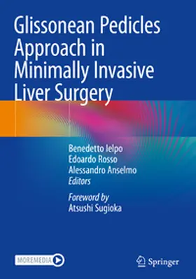 Ielpo / Rosso / Anselmo |  Glissonean Pedicles Approach in Minimally Invasive Liver Surgery | Buch |  Sack Fachmedien