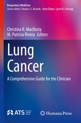 MacRosty / Rivera |  Lung Cancer | Buch |  Sack Fachmedien