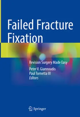 Giannoudis / Tornetta III |  Failed Fracture Fixation | eBook | Sack Fachmedien