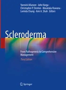 Allanore / Varga / Denton |  Scleroderma | eBook | Sack Fachmedien