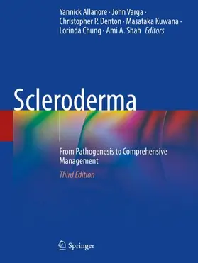 Allanore / Varga / Denton |  Scleroderma | Buch |  Sack Fachmedien