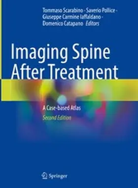 Scarabino / Pollice / Iaffaldano |  Imaging Spine After Treatment | eBook | Sack Fachmedien