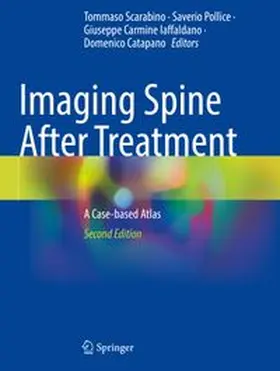 Scarabino / Pollice / Iaffaldano |  Imaging Spine After Treatment | Buch |  Sack Fachmedien