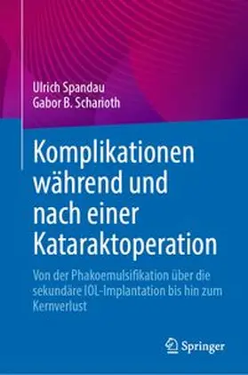 Spandau / Scharioth | Komplikationen während und nach einer Kataraktoperation | Buch | 978-3-031-45983-2 | www.sack.de