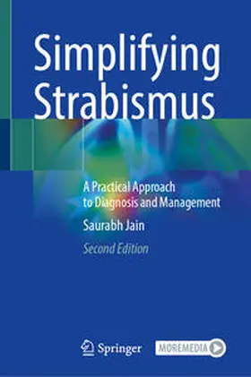 Jain |  Simplifying Strabismus | eBook | Sack Fachmedien