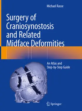 Rasse | Surgery of Craniosynostosis and Related Midface Deformities | E-Book | sack.de