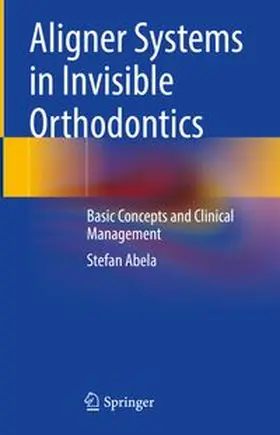 Abela |  Aligner Systems in Invisible Orthodontics | eBook | Sack Fachmedien