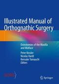 Kessler / Hardt / Yamauchi |  Illustrated Manual of Orthognathic Surgery | Buch |  Sack Fachmedien
