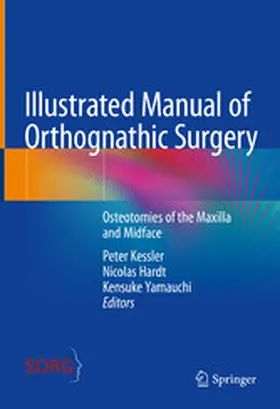 Kessler / Hardt / Yamauchi |  Illustrated Manual of Orthognathic Surgery | eBook | Sack Fachmedien