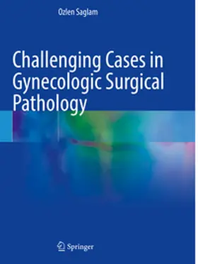 Saglam |  Challenging Cases in Gynecologic Surgical Pathology | Buch |  Sack Fachmedien