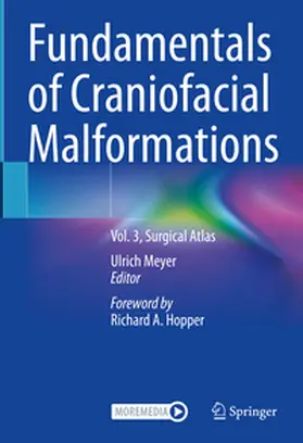 Meyer |  Fundamentals of Craniofacial Malformations | Buch |  Sack Fachmedien