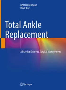 Hintermann / Ruiz |  Total Ankle Replacement | Buch |  Sack Fachmedien