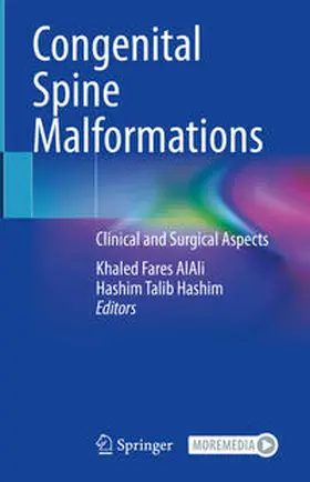 AlAli / Hashim |  Congenital Spine Malformations | Buch |  Sack Fachmedien