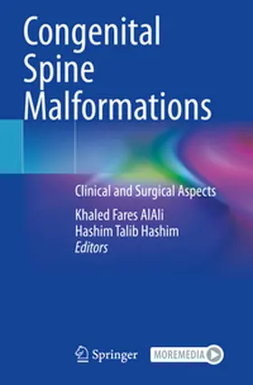 AlAli / Hashim |  Congenital Spine Malformations | Buch |  Sack Fachmedien