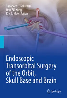 Schwartz / Kong / Moe | Endoscopic Transorbital Surgery of the Orbit, Skull Base and Brain | E-Book | www.sack.de