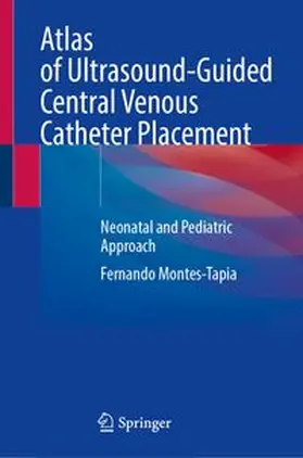 Montes-Tapia |  Atlas of Ultrasound-Guided Central Venous Catheter Placement | eBook | Sack Fachmedien