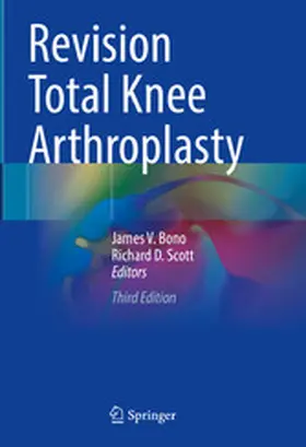 Bono / Scott |  Revision Total Knee Arthroplasty | eBook | Sack Fachmedien