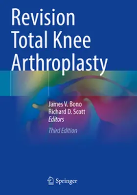 Bono / Scott |  Revision Total Knee Arthroplasty | Buch |  Sack Fachmedien