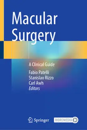 Patelli / Rizzo / Awh |  Macular Surgery | eBook | Sack Fachmedien