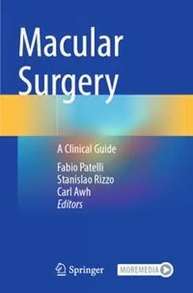 Patelli / Rizzo / Awh | Macular Surgery | Buch | 978-3-031-63510-6 | www.sack.de