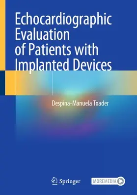 Toader | Echocardiographic Evaluation of Patients with Implanted Devices | Buch | 978-3-031-64078-0 | www.sack.de