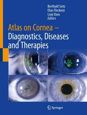 Seitz / Flockerzi / Daas |  Atlas on Cornea | Buch |  Sack Fachmedien