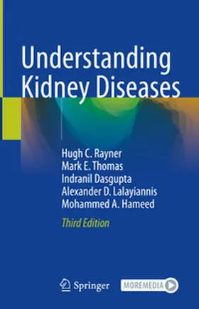Rayner / Thomas / Dasgupta |  Understanding Kidney Diseases | Buch |  Sack Fachmedien