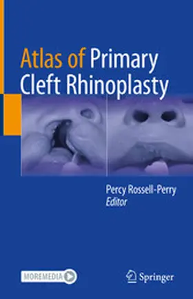 Rossell-Perry |  Atlas of Primary Cleft Rhinoplasty | eBook | Sack Fachmedien