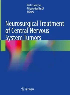 Gagliardi / Mortini |  Neurosurgical Treatment of Central Nervous System Tumors | Buch |  Sack Fachmedien