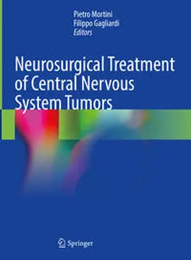 Mortini / Gagliardi | Neurosurgical Treatment of Central Nervous System Tumors | E-Book | www.sack.de