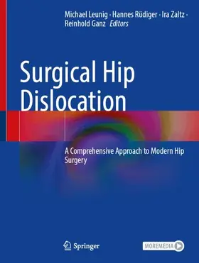 Leunig / Rüdiger / Zaltz |  Surgical Hip Dislocation | Buch |  Sack Fachmedien