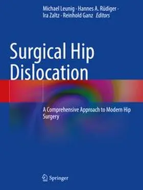 Leunig / Rüdiger / Zaltz |  Surgical Hip Dislocation | Buch |  Sack Fachmedien
