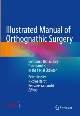 Kessler / Yamauchi / Hardt |  Illustrated Manual of Orthognathic Surgery | Buch |  Sack Fachmedien