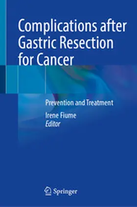 Fiume |  Complications after Gastric Resection for Cancer | eBook | Sack Fachmedien